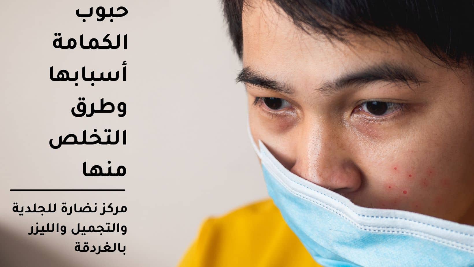 حبوب الكمامة أسباب ظهورها وطرق التخلص منها